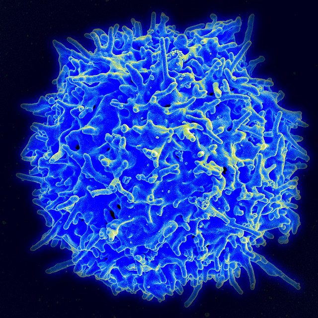 Novel-CAR-T-cell-therapy-obe-cel-demonstrates-high-response-rates.jpg