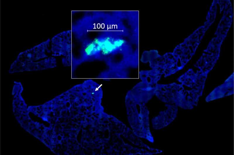 Research using non-toxic bacteria to fight high-mortality cancers prepares for clinical trials