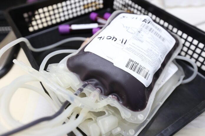 Research-reveals-gender-gap-in-trauma-whole-blood-transfusions.jpg