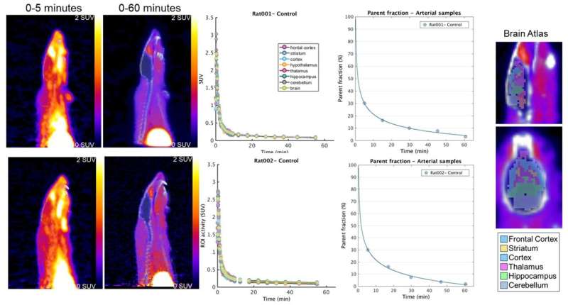 Scientists use Nobel prize-winning 'click chemistry' to determine distribution of medication in the brain