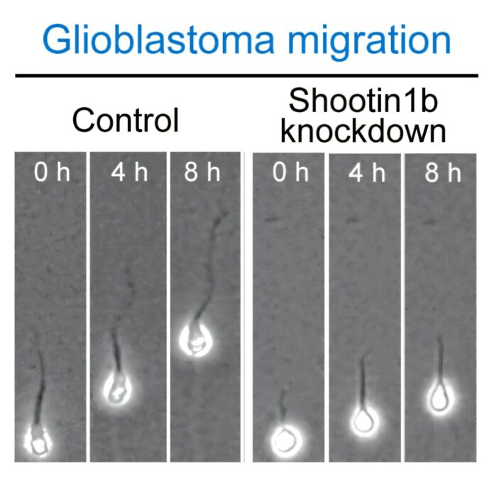Identifying-the-interactions-that-drive-cell-migration-in-brain-cancer.jpg